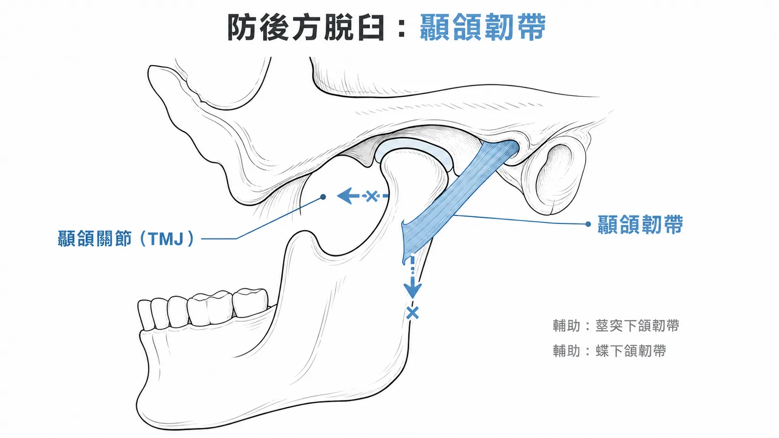 顳頷關節側面:顳頷韌帶限制後方與下方移動防脫臼