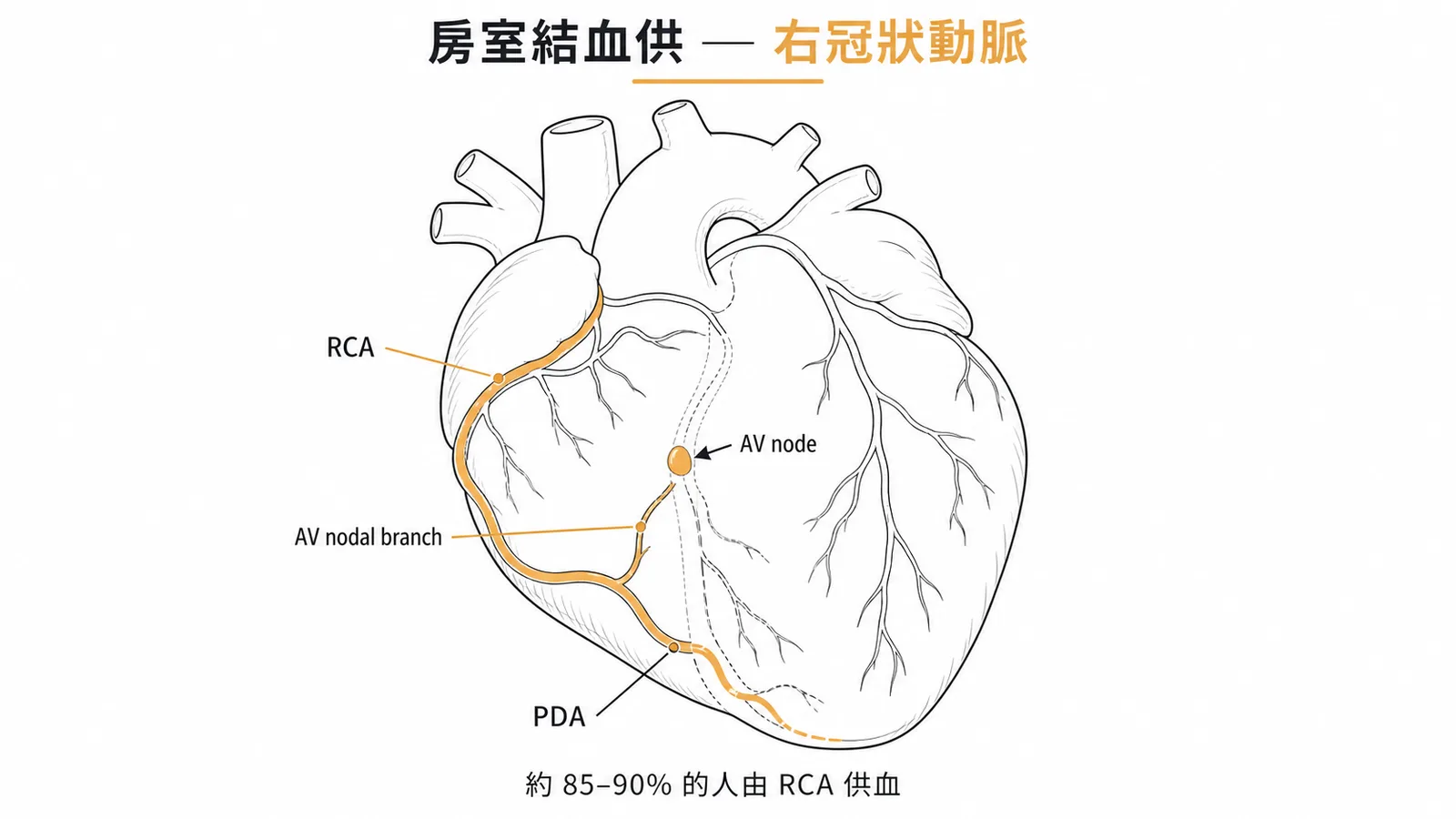 房室結血液供應:約85-90%由右冠狀動脈(RCA)的房室結支供血