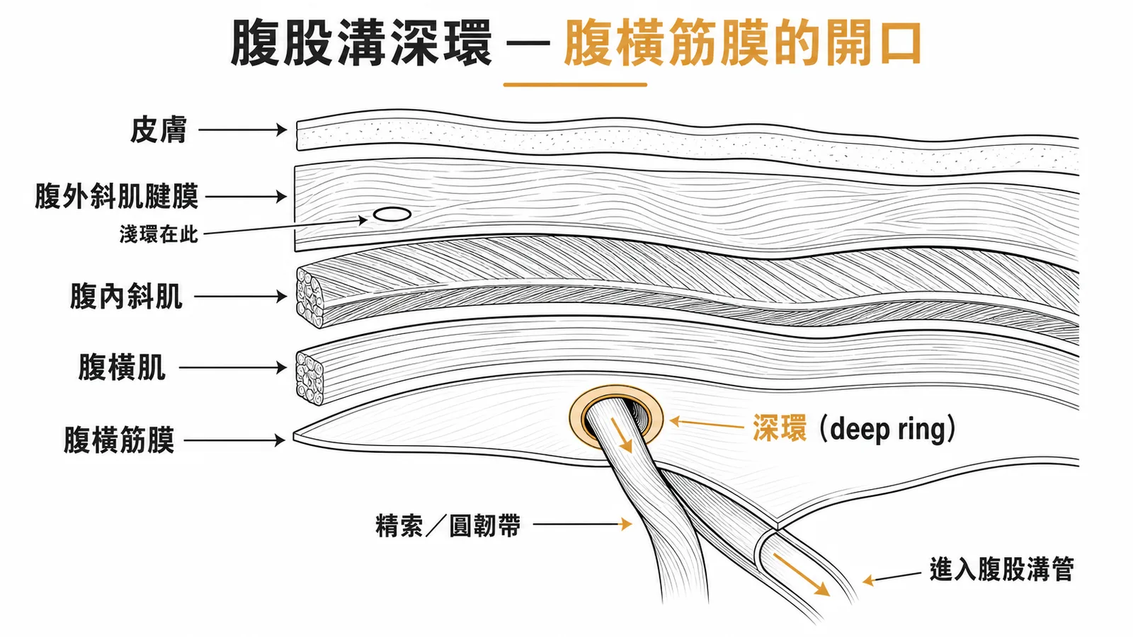 腹股溝深環是腹橫筋膜的開口，精索由此穿過進入腹股溝管