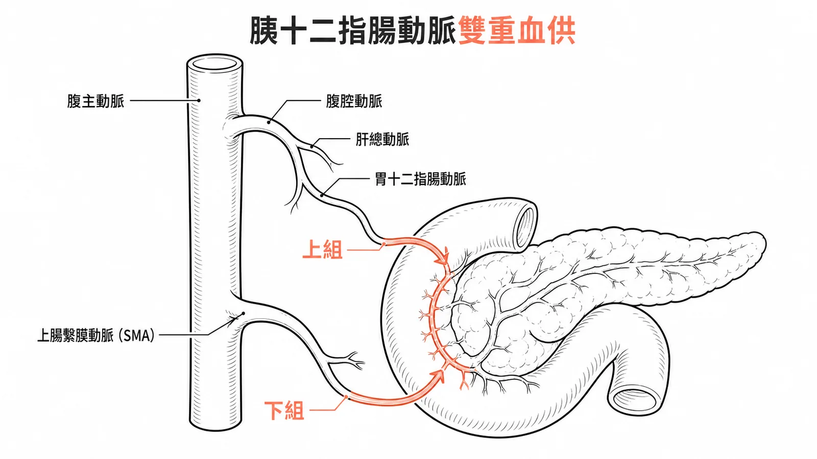 胰十二指腸動脈雙重血供：上組來自腹腔動脈系統，下組直接來自SMA