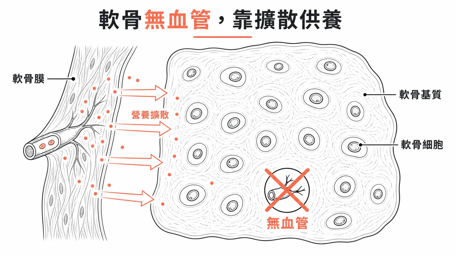 軟骨組織無血管，營養靠軟骨膜擴散供應