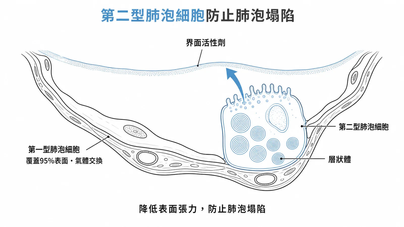 第二型肺泡細胞含層狀體，分泌界面活性劑降低表面張力防止肺泡塌陷