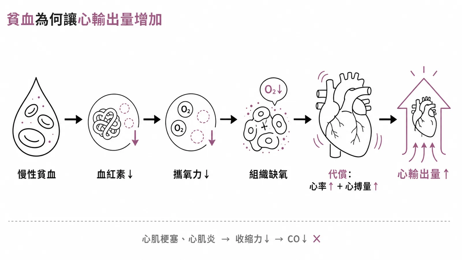 慢性貧血代償機轉：血紅素下降致攜氧力不足，代償增加心率與心搏量提高心輸出量