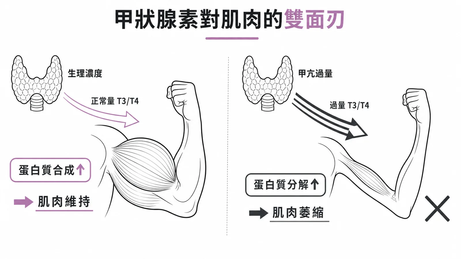 甲狀腺素對肌肉蛋白質代謝的雙面效應：生理濃度促合成，甲亢過量促分解致肌肉萎縮