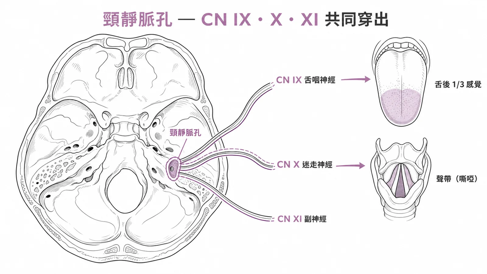頸靜脈孔穿出CN IX X XI三條神經與臨床對應