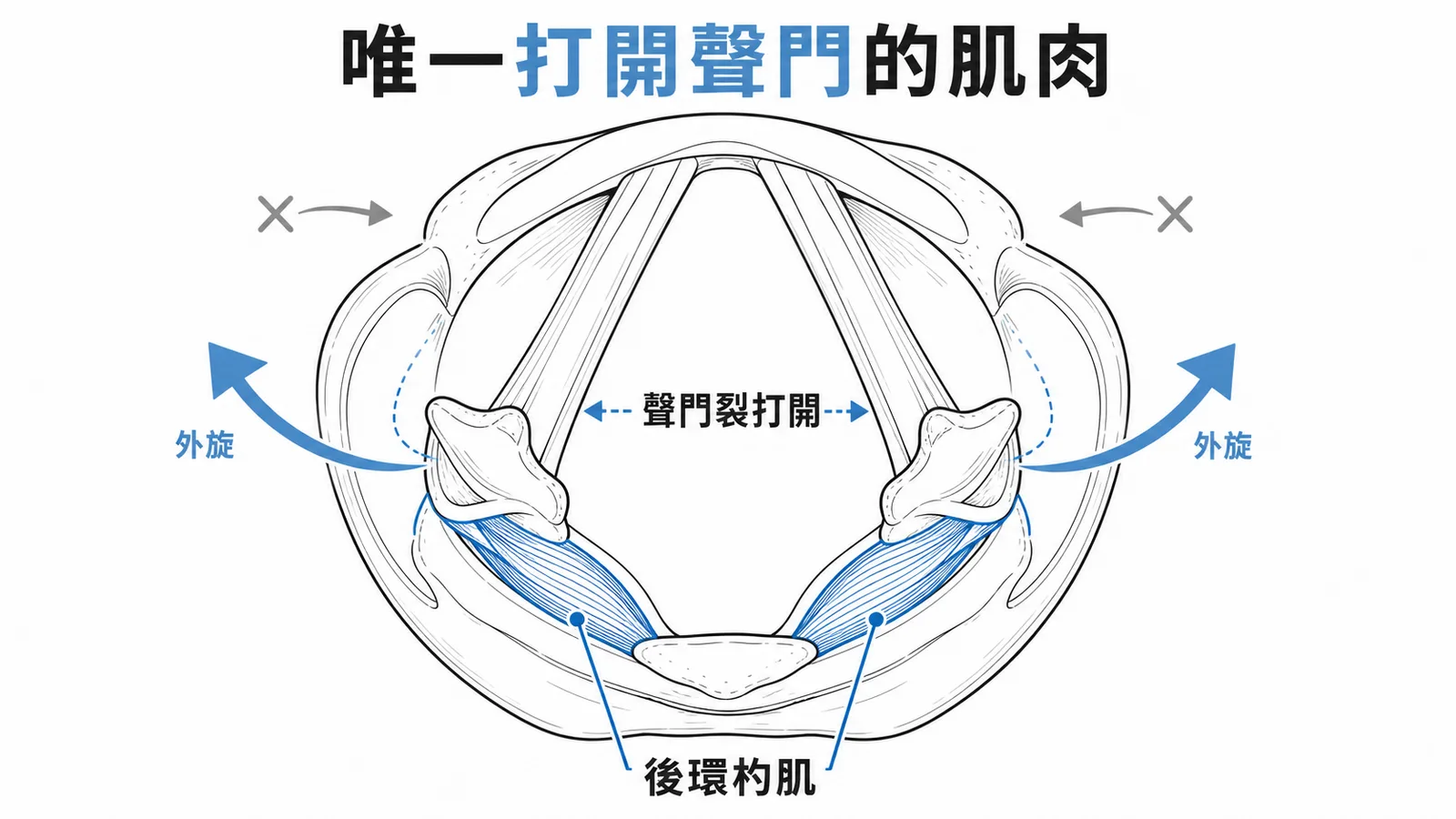 後環杓肌使杓狀軟骨外旋，是唯一打開聲門裂的喉內肌