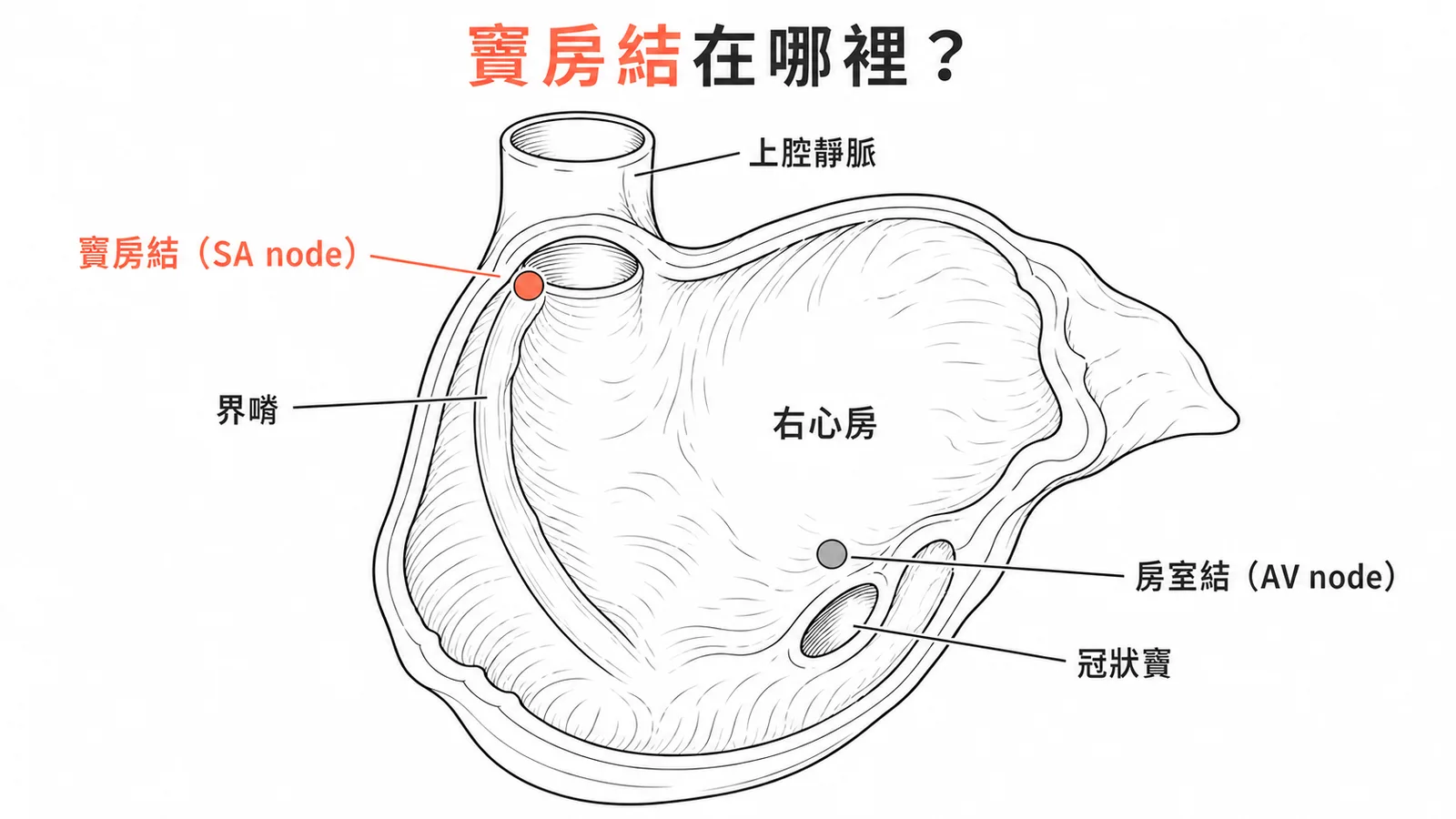 竇房結位於右心房界嵴上端、靠近上腔靜脈開口處