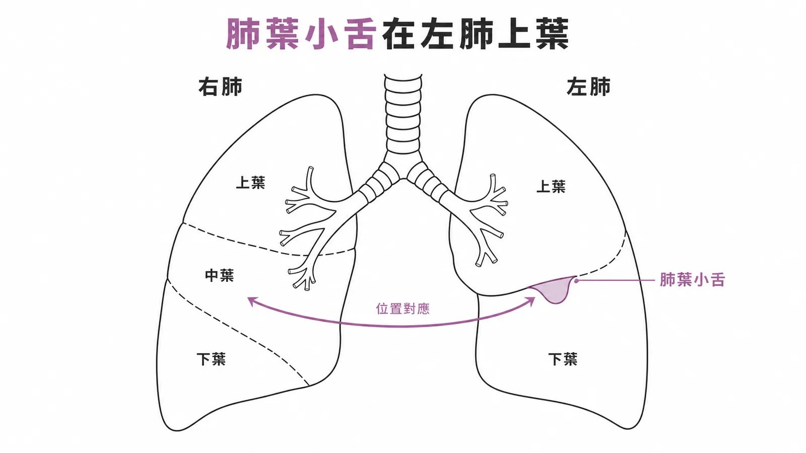 左右肺對比:肺葉小舌位於左肺上葉下緣,對應右肺中葉
