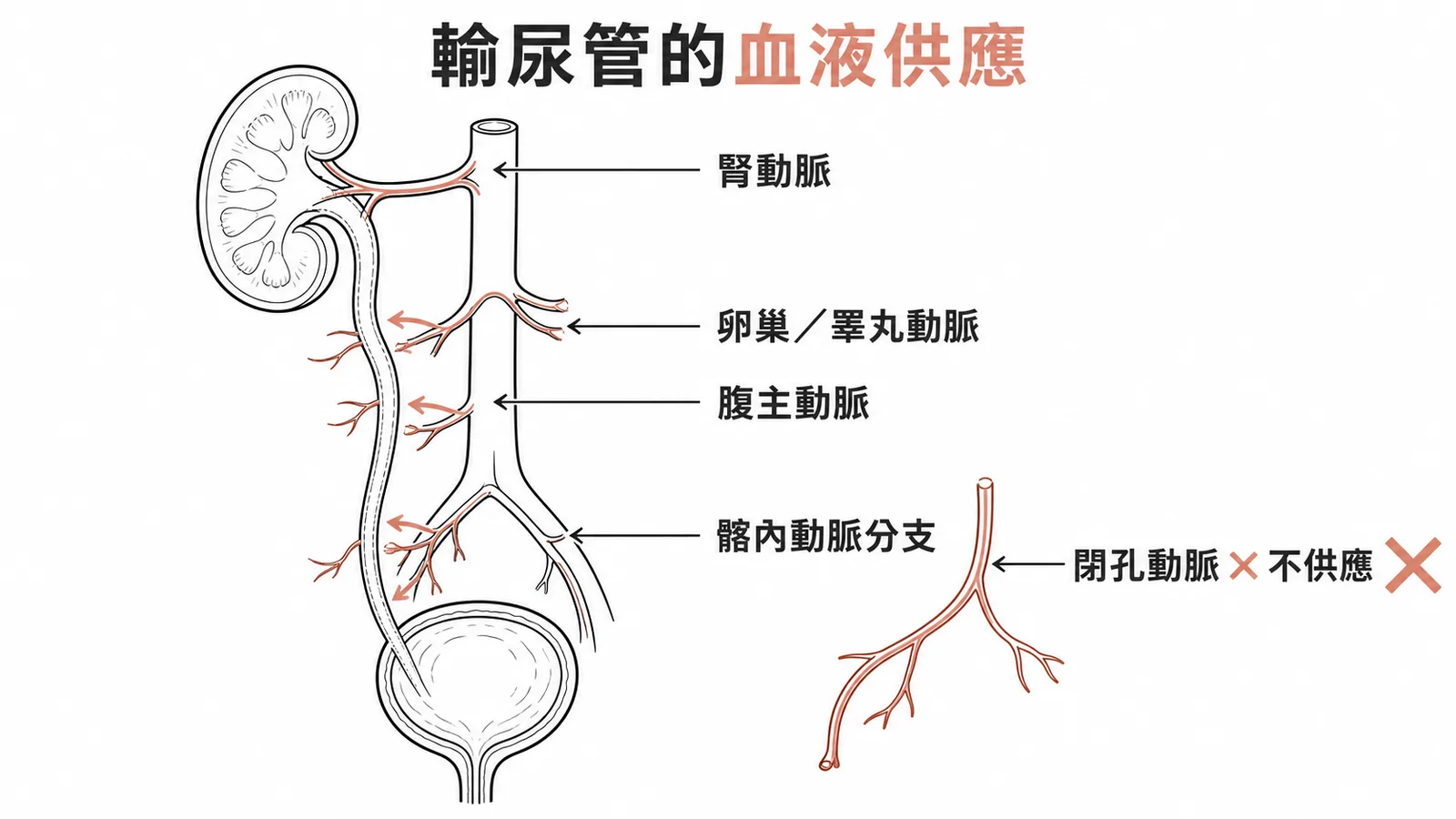 輸尿管多源性血液供應示意