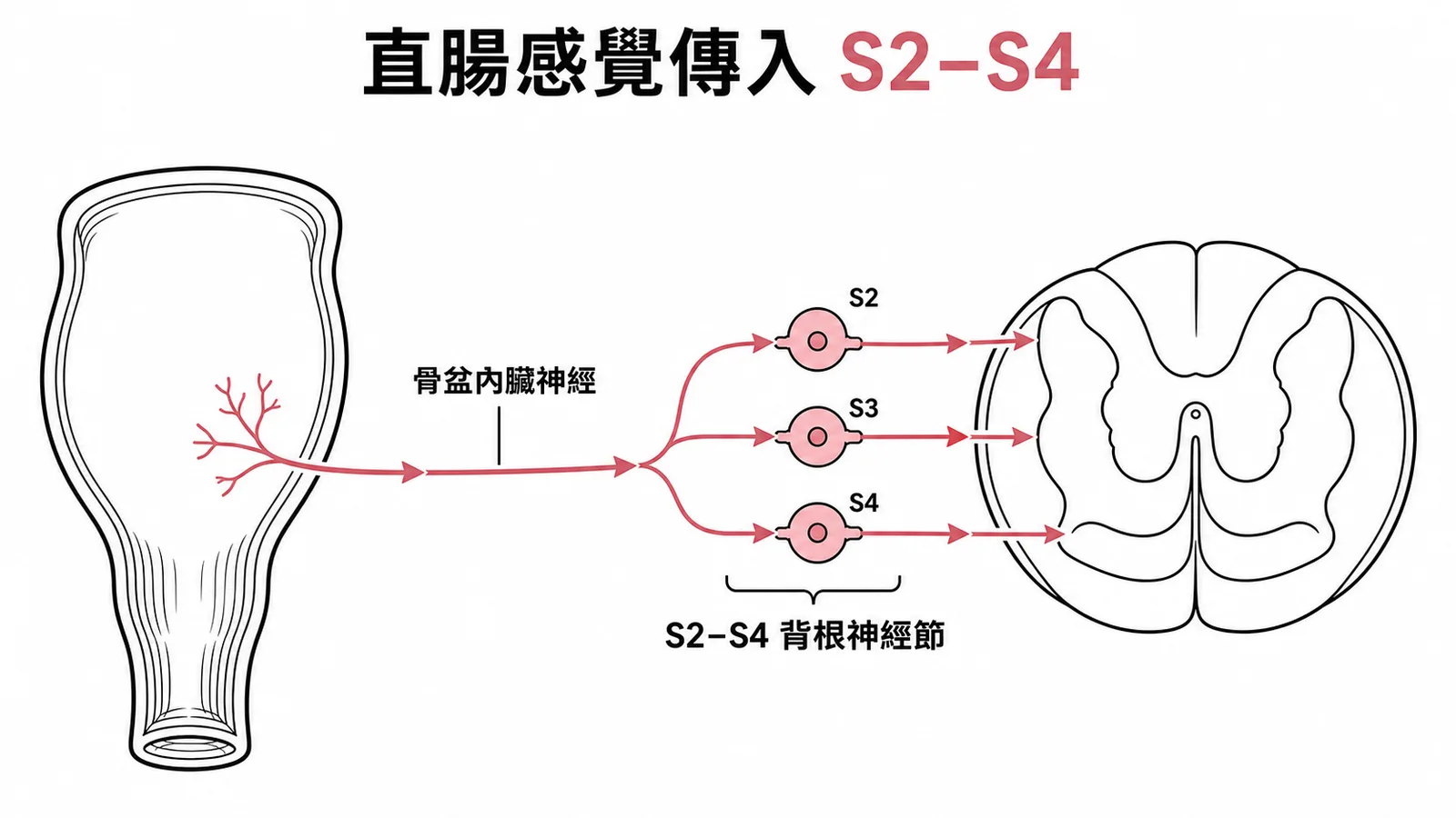 直腸內臟感覺經骨盆內臟神經傳至 S2-S4 示意