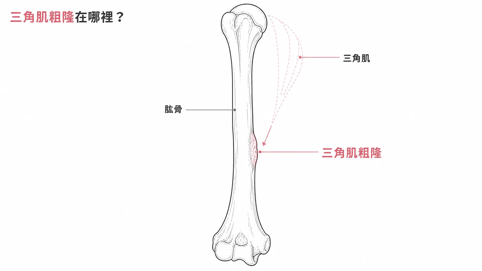 三角肌粗隆位於肱骨外側中段示意