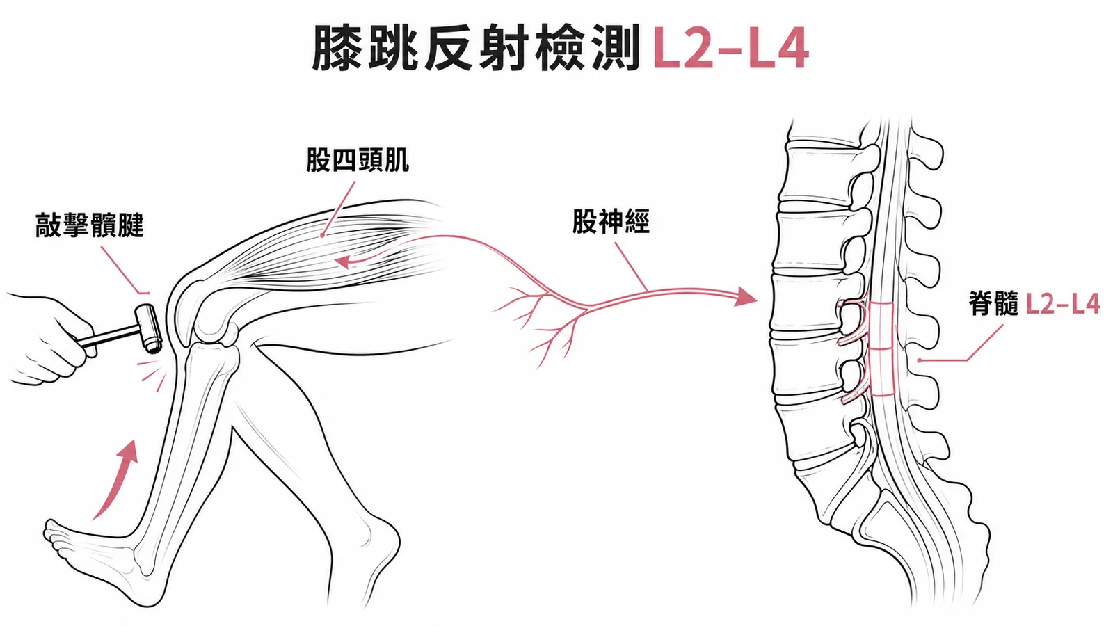 膝跳反射經股神經傳入脊髓L2-L4的反射弧示意圖