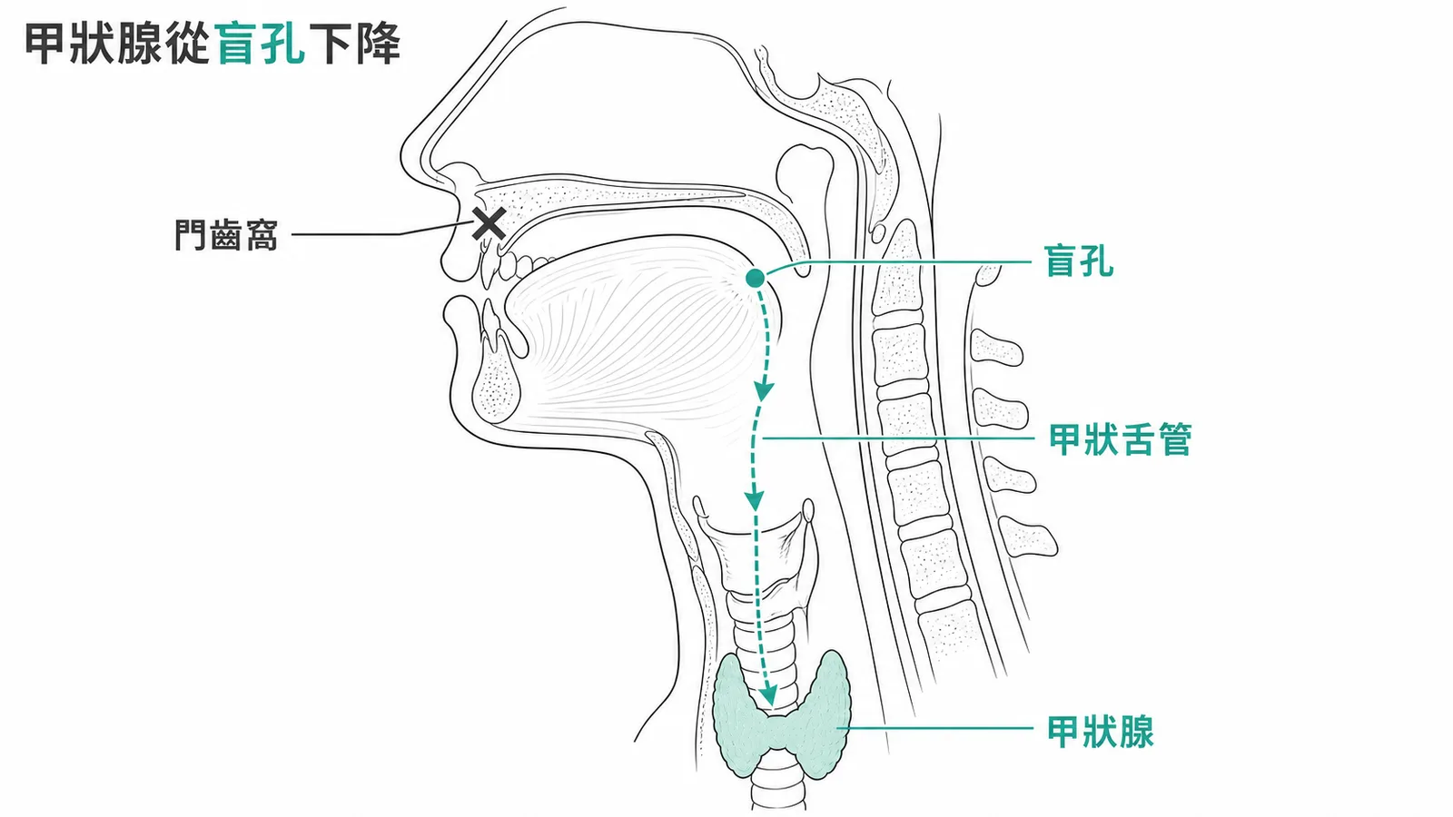 甲狀腺從舌根盲孔沿甲狀舌管下降至頸部的發育路徑圖