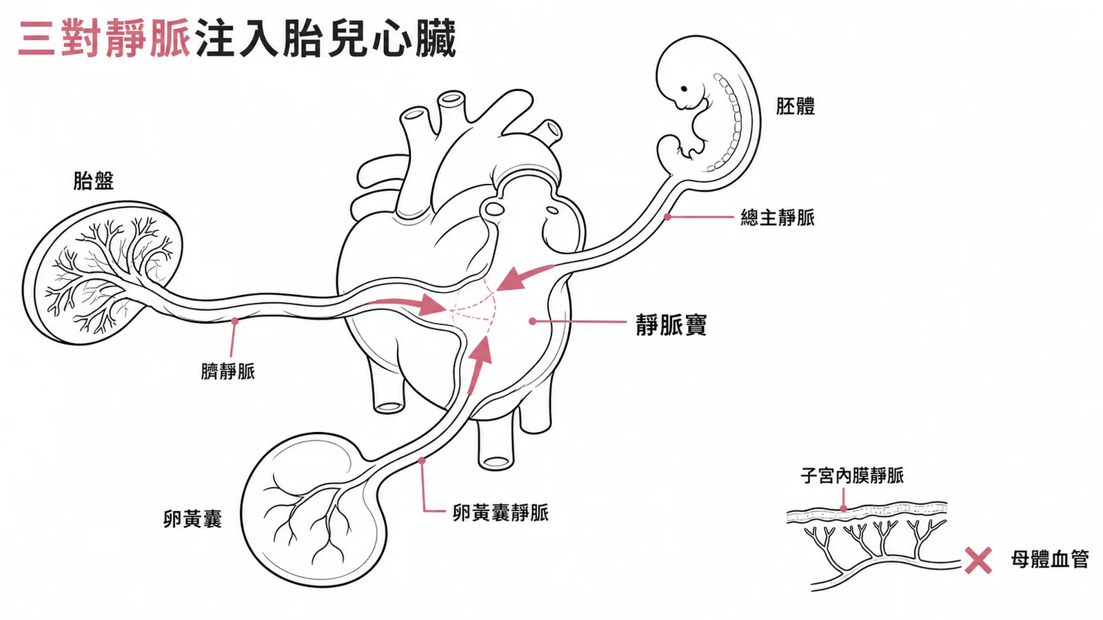 胚胎第四週三對靜脈匯入胎兒心臟靜脈竇的示意圖