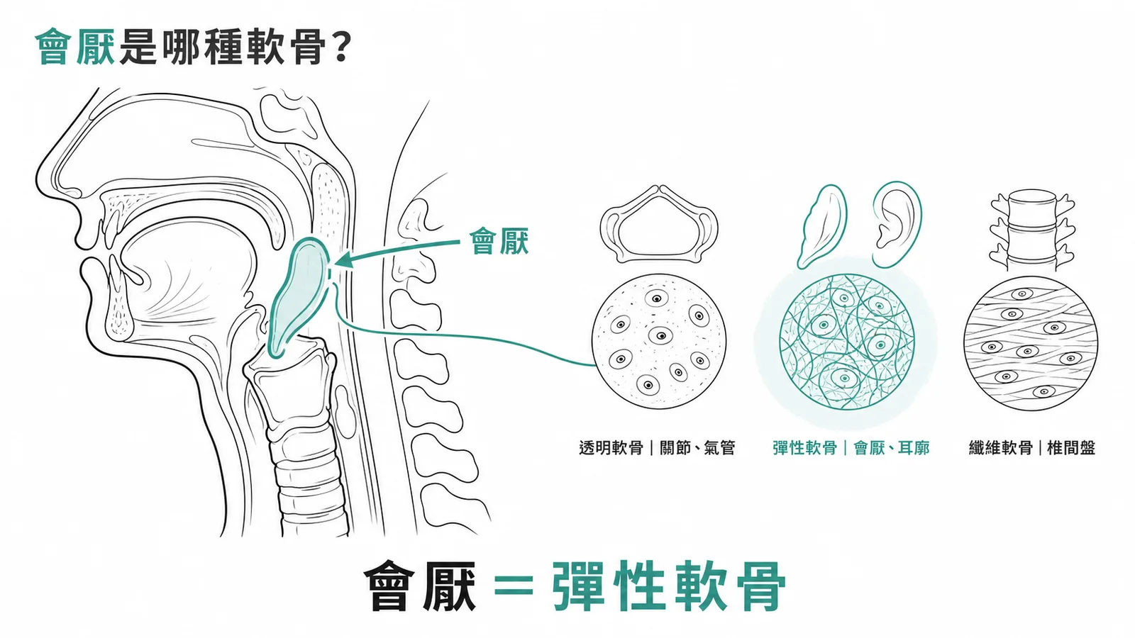 三種軟骨分類對照：透明軟骨、彈性軟骨、纖維軟骨與各自分布位置，會厭為彈性軟骨