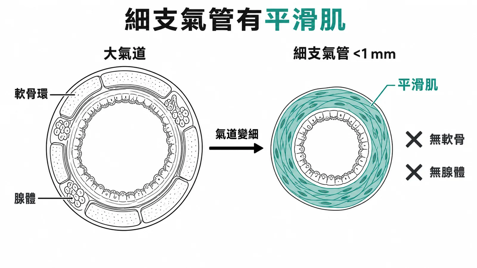 細支氣管與大氣道截面對比：細支氣管有平滑肌，無軟骨無腺體
