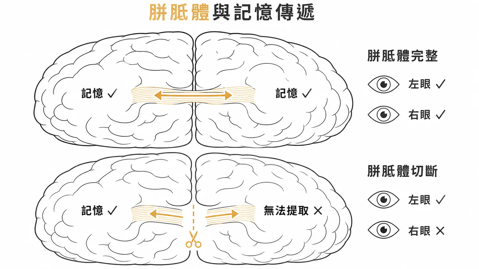 胼胝體完整與切斷後記憶傳遞差異圖