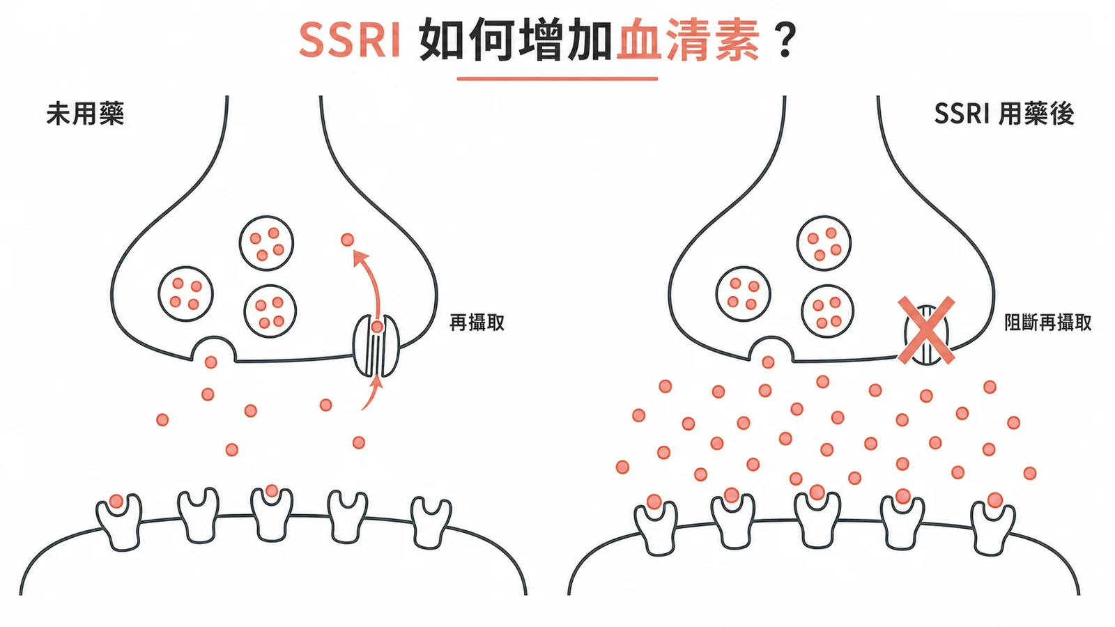 SSRI阻斷再攝取使突觸間隙血清素增加示意圖