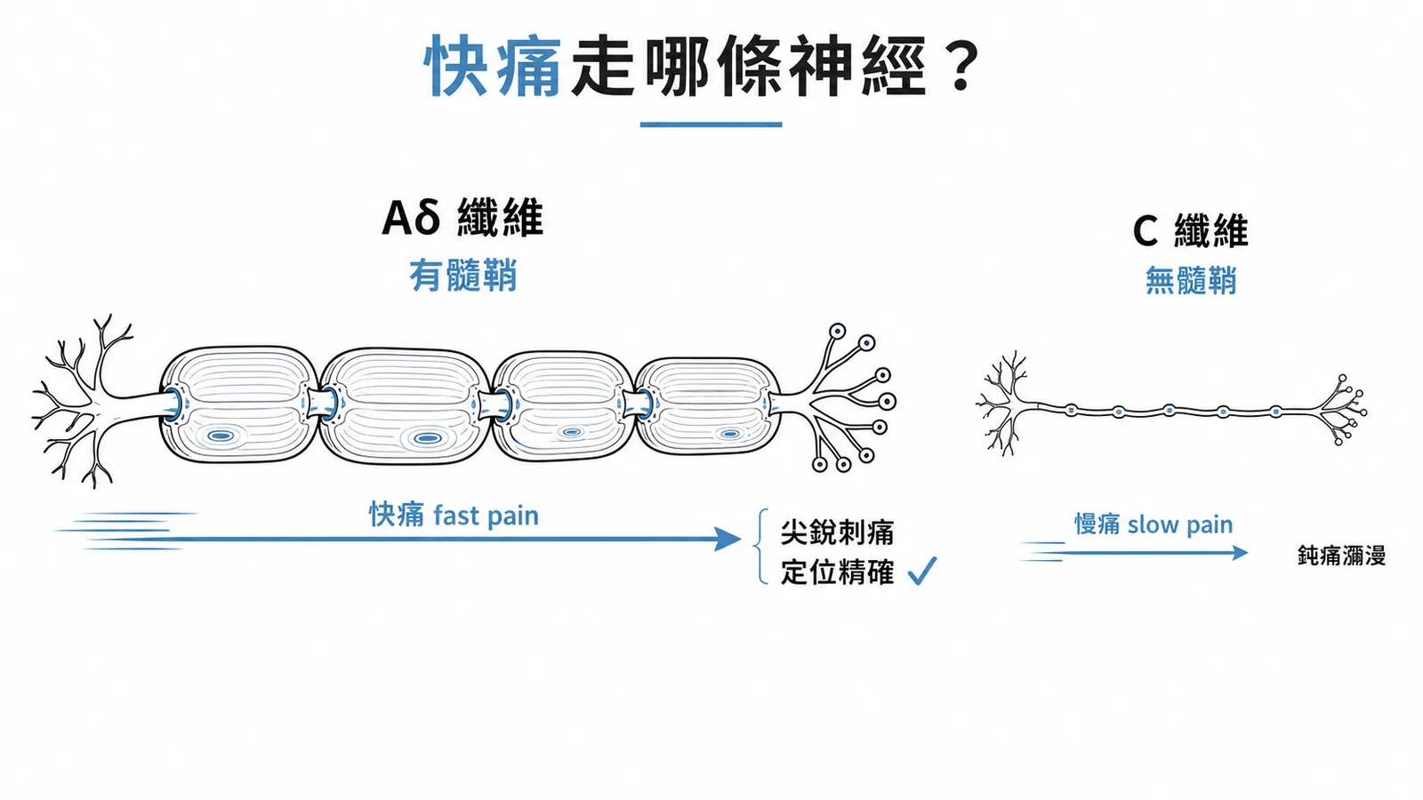 Aδ纖維有髓鞘傳快痛與C纖維無髓鞘傳慢痛對照圖
