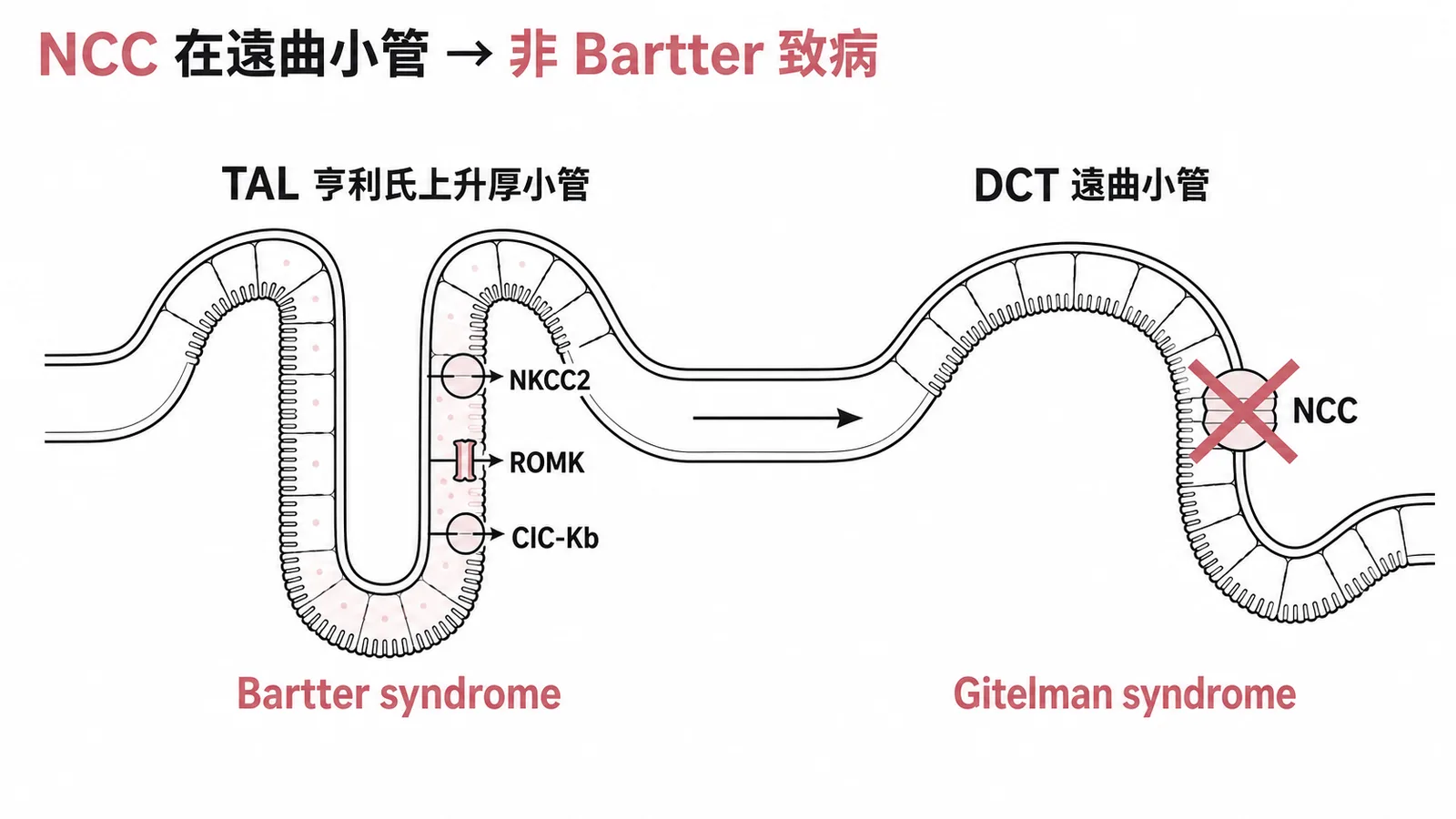 TAL上NKCC2和ROMK及ClC-Kb與Bartter相關而NCC位於DCT屬Gitelman