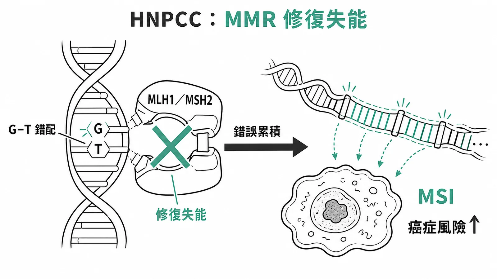 HNPCC 的 MMR 修復失能導致微衛星不穩定示意圖