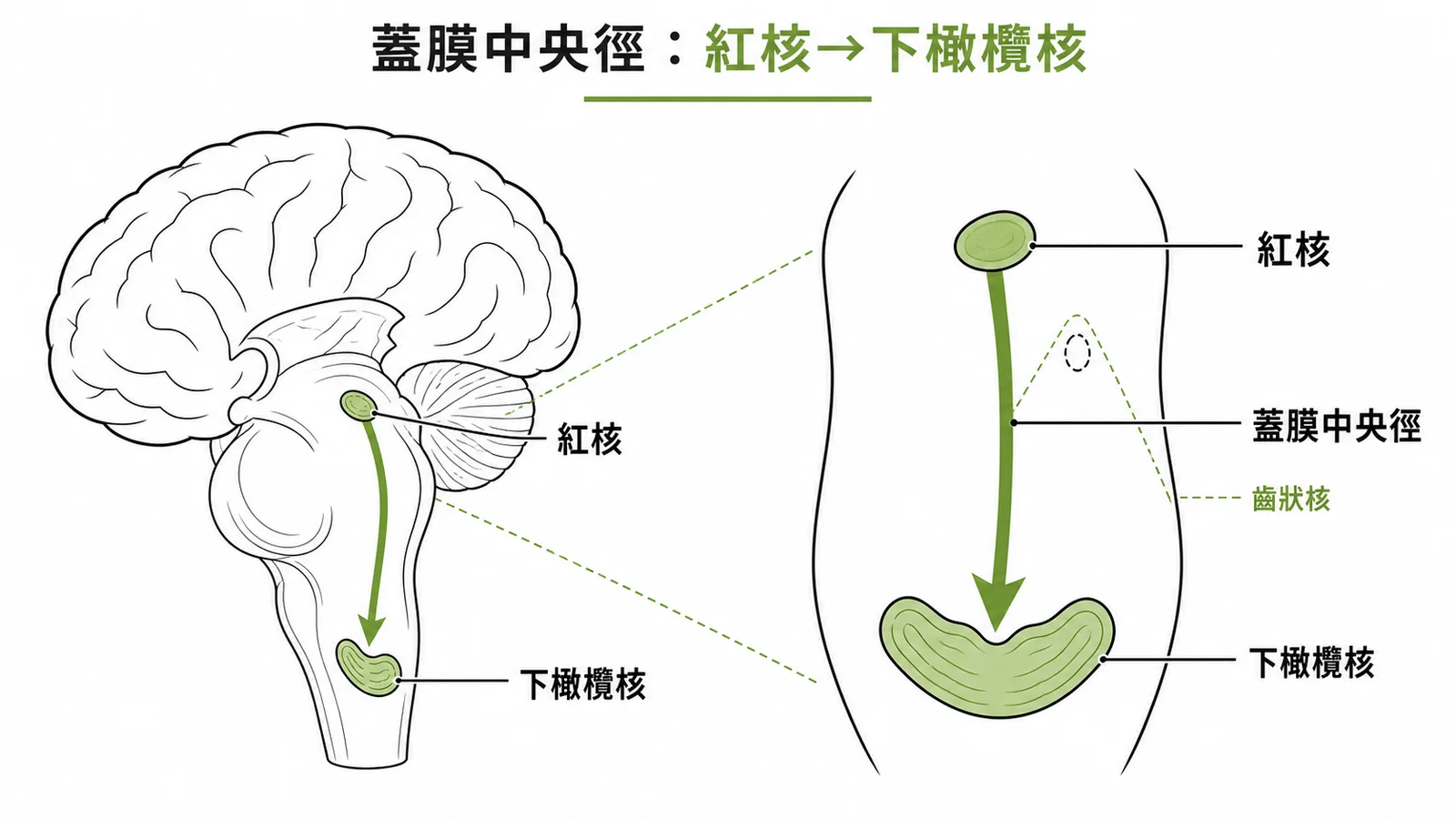 蓋膜中央徑連接紅核與下橄欖核,構成吉蘭-莫拉雷三角
