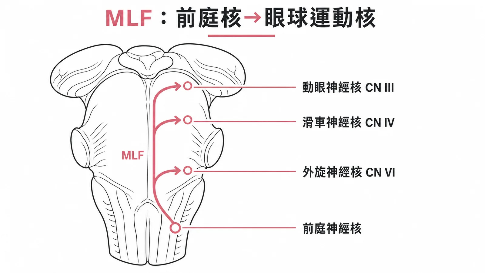 內側縱束連接前庭神經核與眼球運動核,協調前庭眼反射