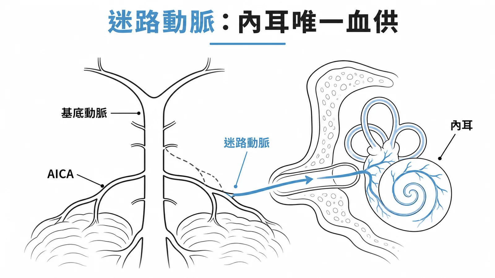 迷路動脈是內耳膜迷路唯一血供來源，源自基底動脈或AICA