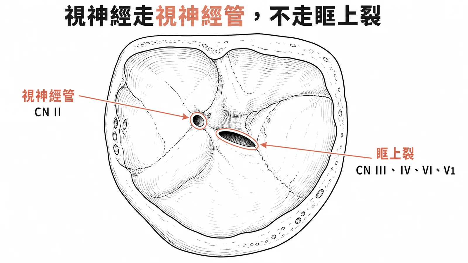 視神經(CN II)走視神經管而非眶上裂,眶上裂讓CN III、IV、VI、V1通過