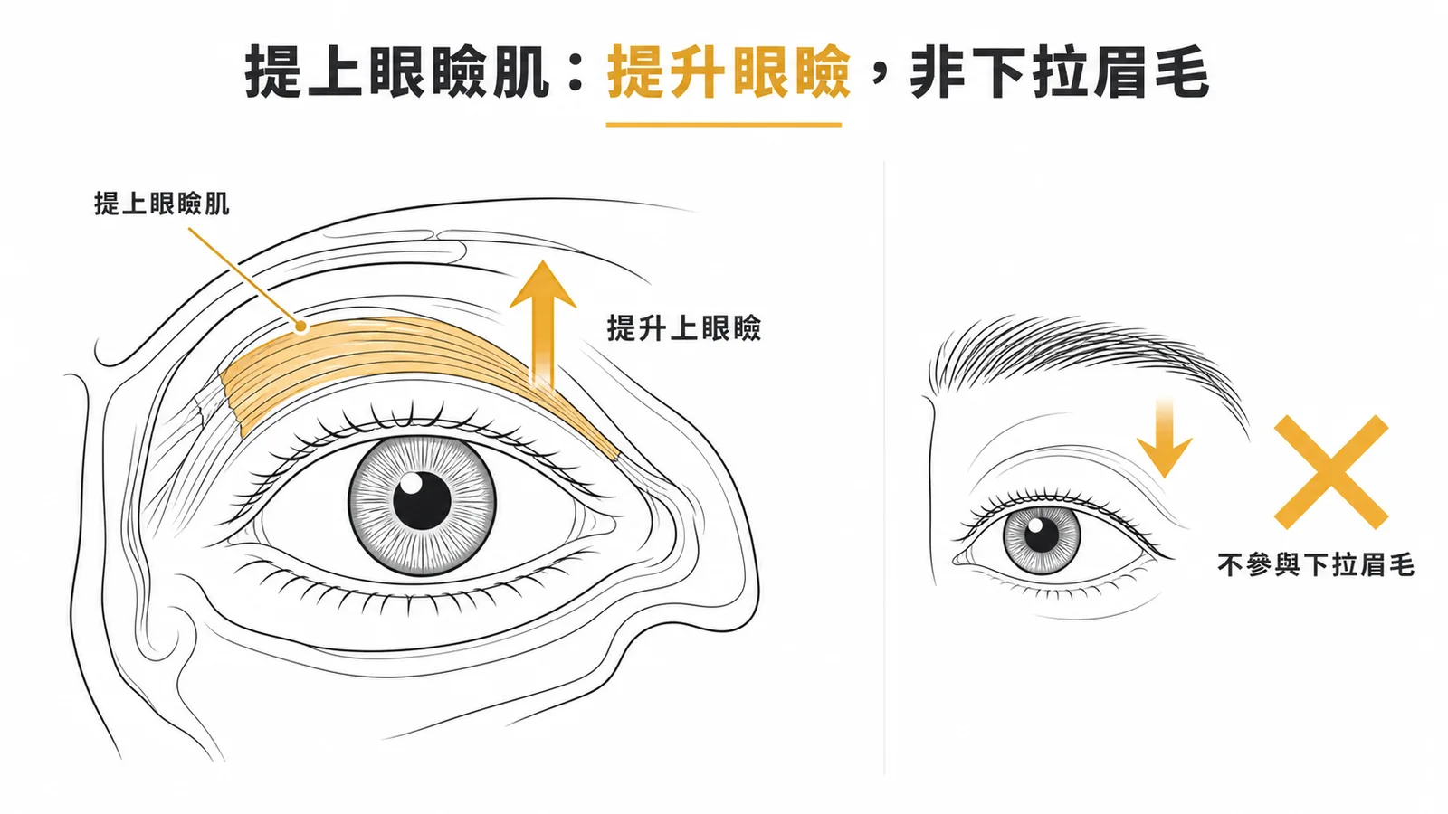 提上眼瞼肌功能是提升上眼瞼而非下拉眉毛