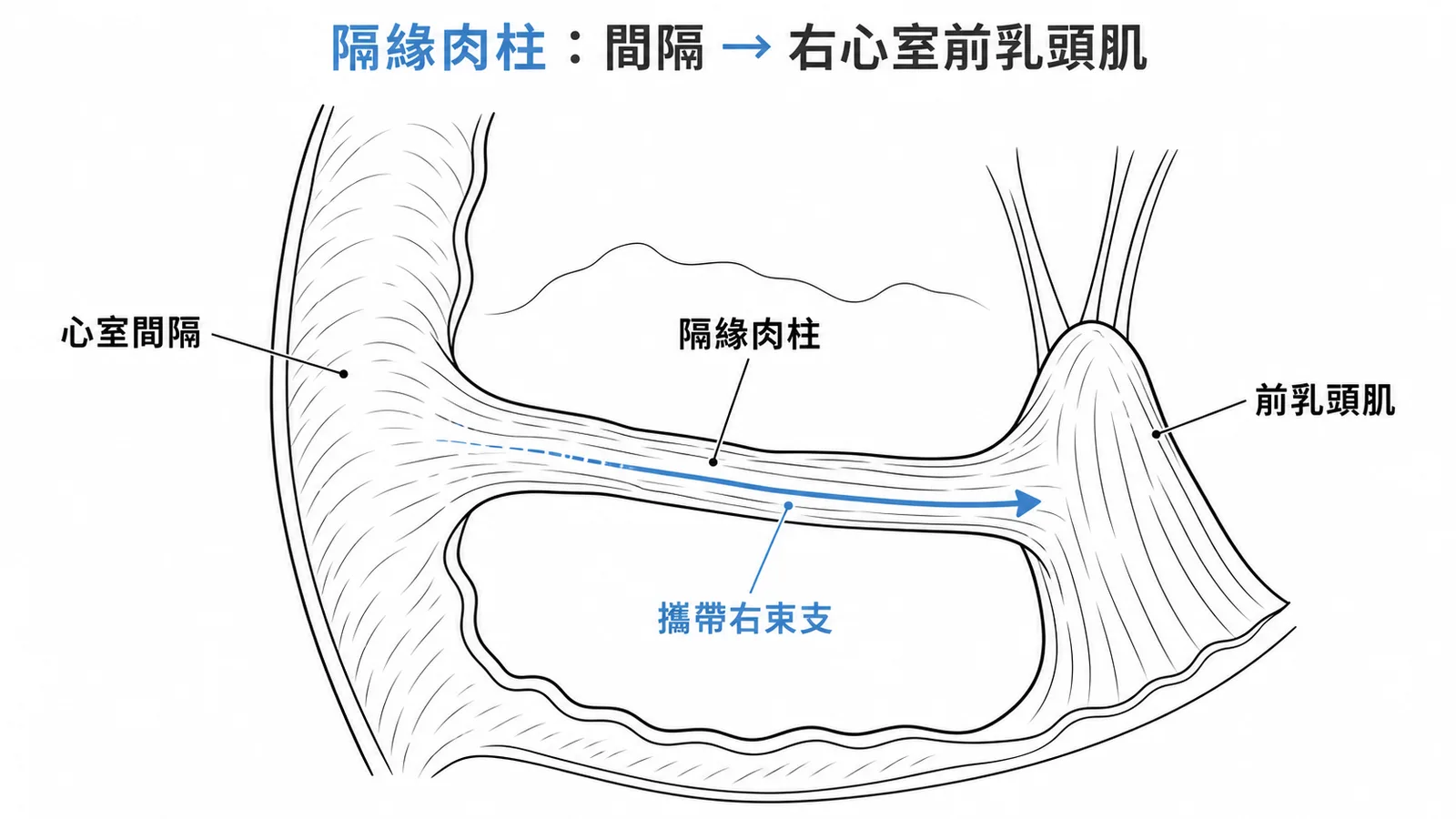 隔緣肉柱從心室間隔連接到右心室前乳頭肌並攜帶右束支