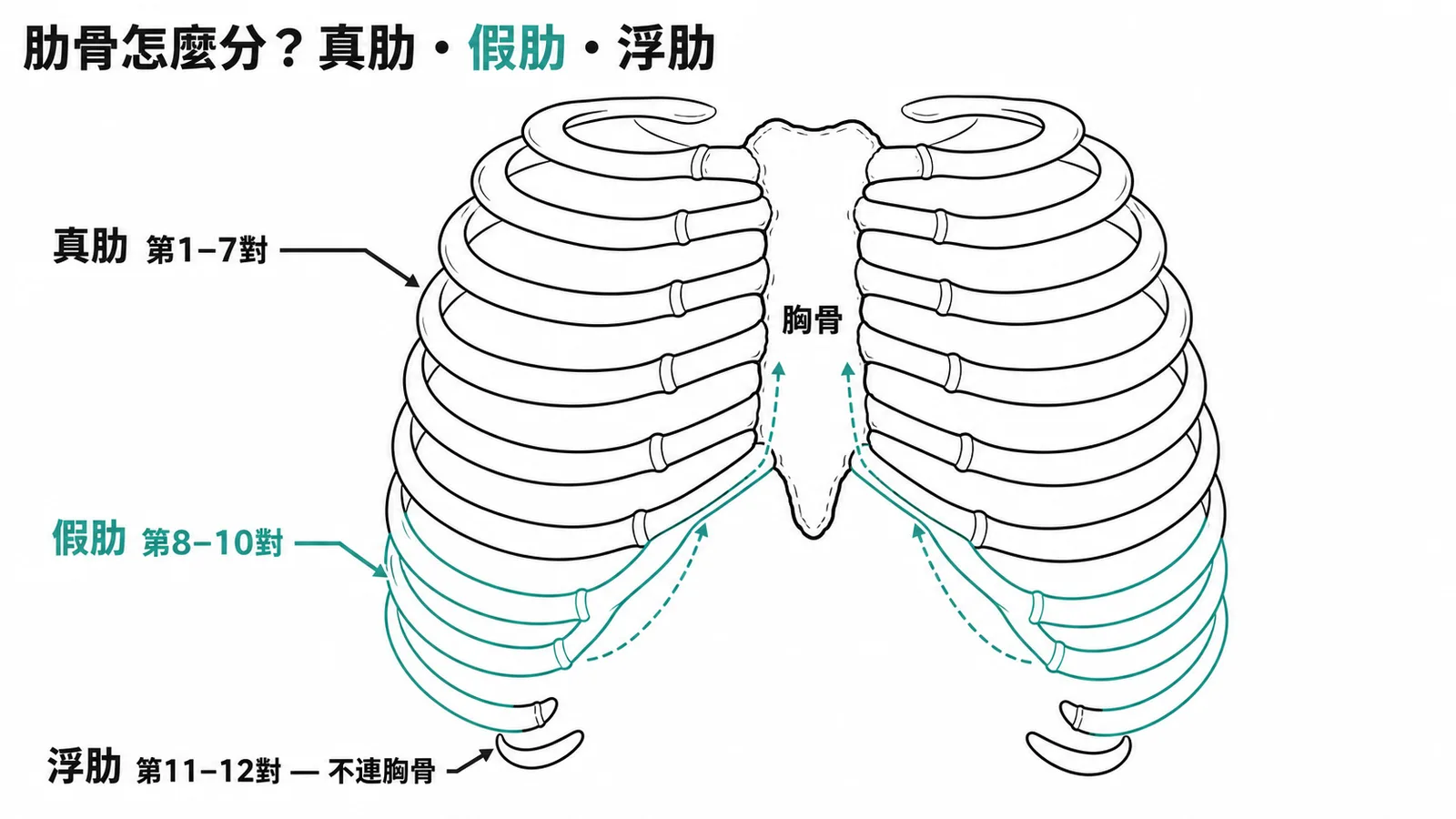 肋骨三分類:真肋直連胸骨、假肋間接連、浮肋不連
