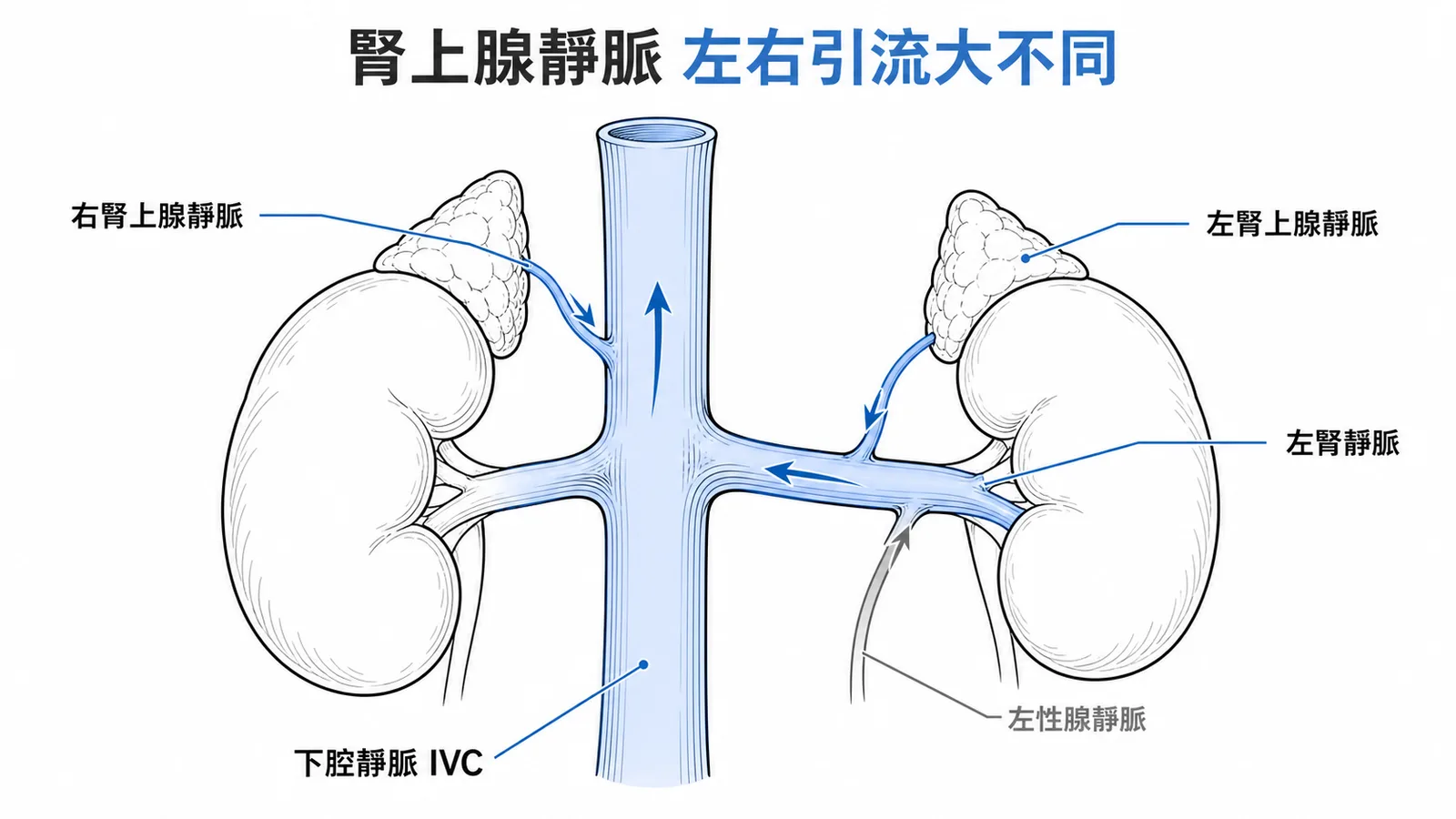 腎上腺靜脈左右引流不對稱：左入腎靜脈、右入IVC