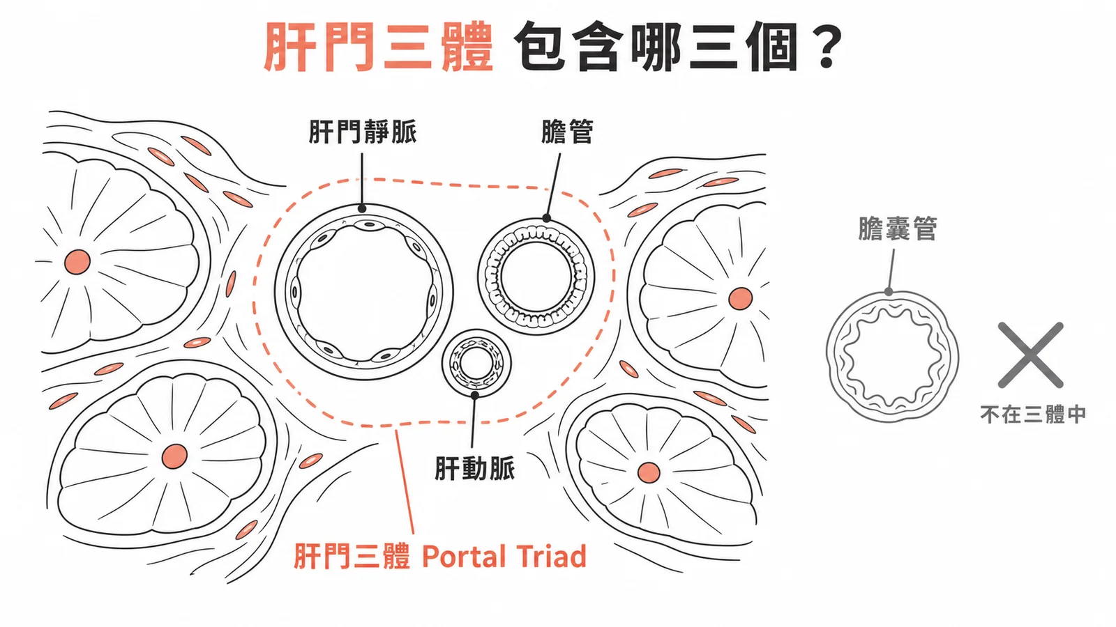肝門三體：肝門靜脈、肝動脈、膽管；膽囊管不在其中