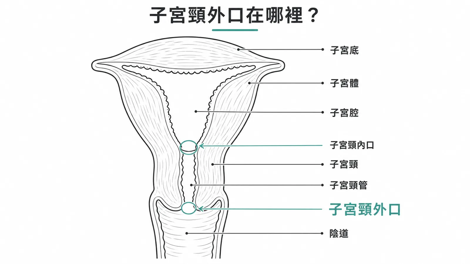 子宮剖面:子宮頸外口位於頸管與陰道交界