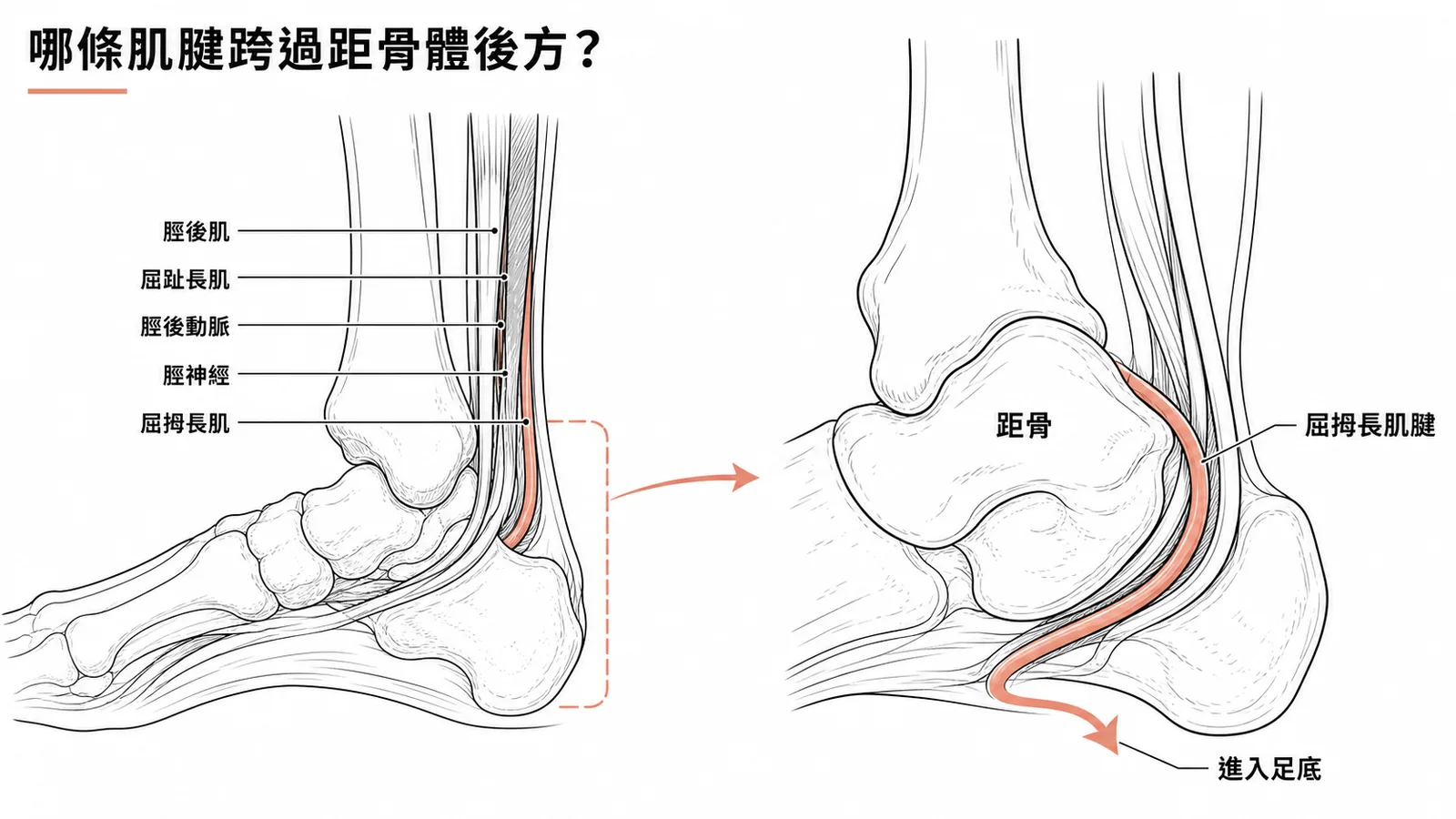 屈拇長肌肌腱繞過距骨體後方進入足底的路徑示意圖