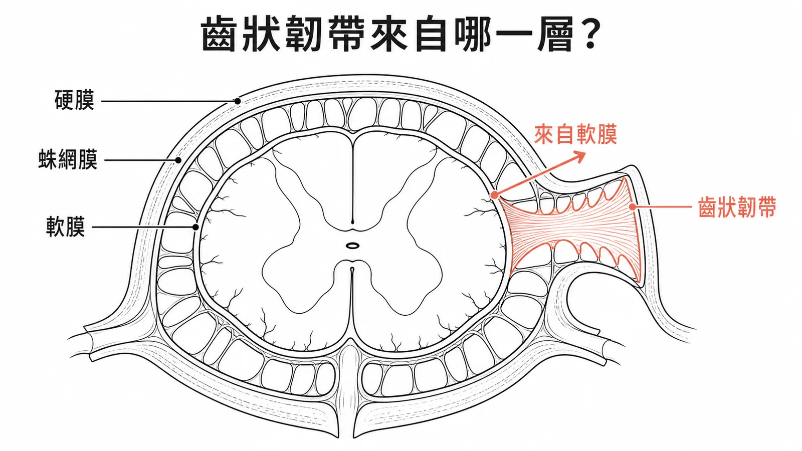 脊髓橫切面齒狀韌帶由軟膜延伸至硬膜的示意圖