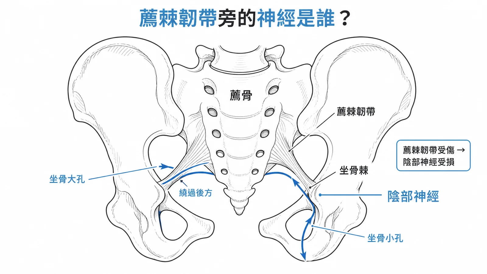 陰部神經繞過薦棘韌帶後方進入坐骨小孔的路徑示意圖