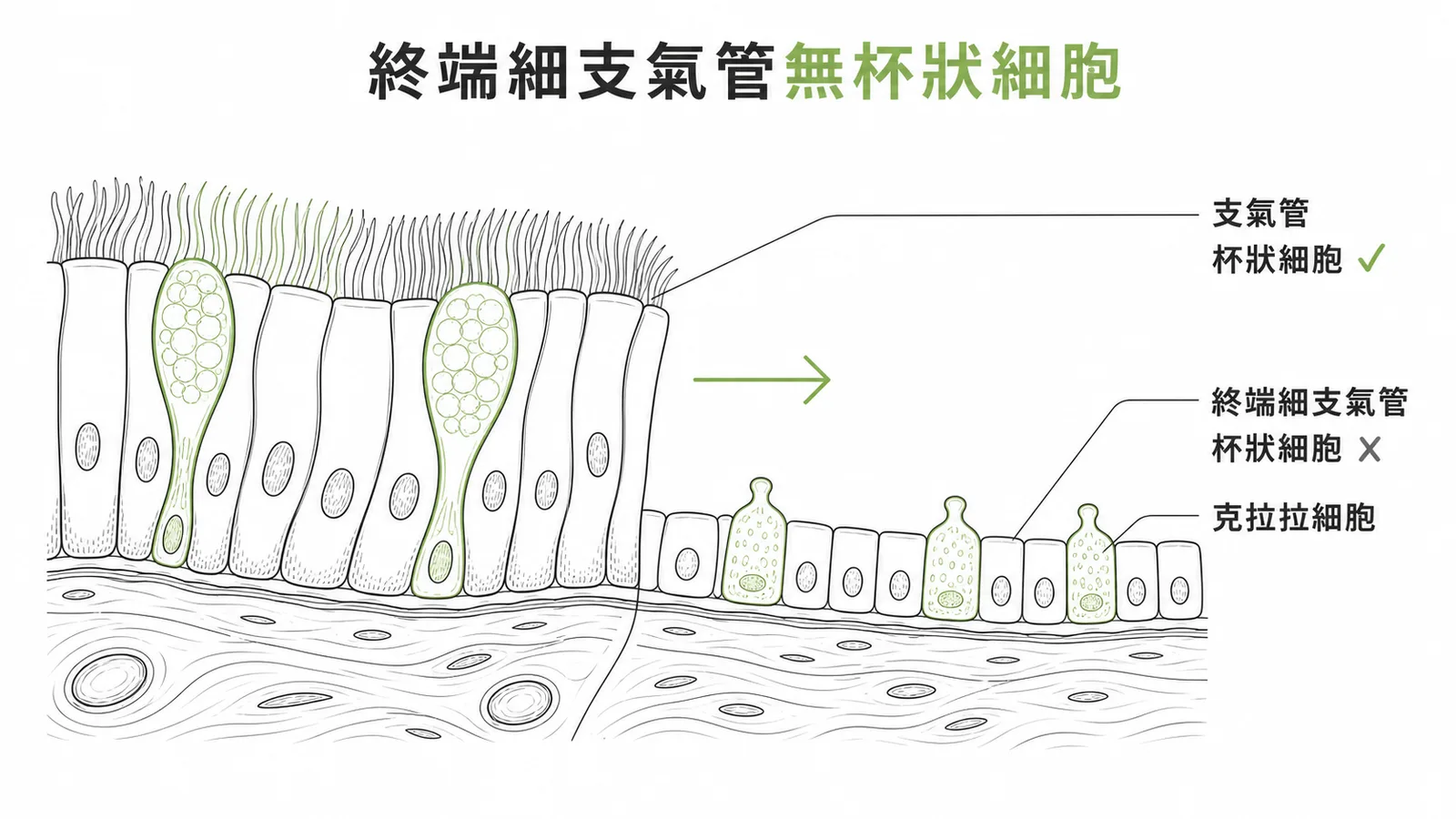 支氣管與終端細支氣管上皮對比：終端細支氣管無杯狀細胞，改由克拉拉細胞取代