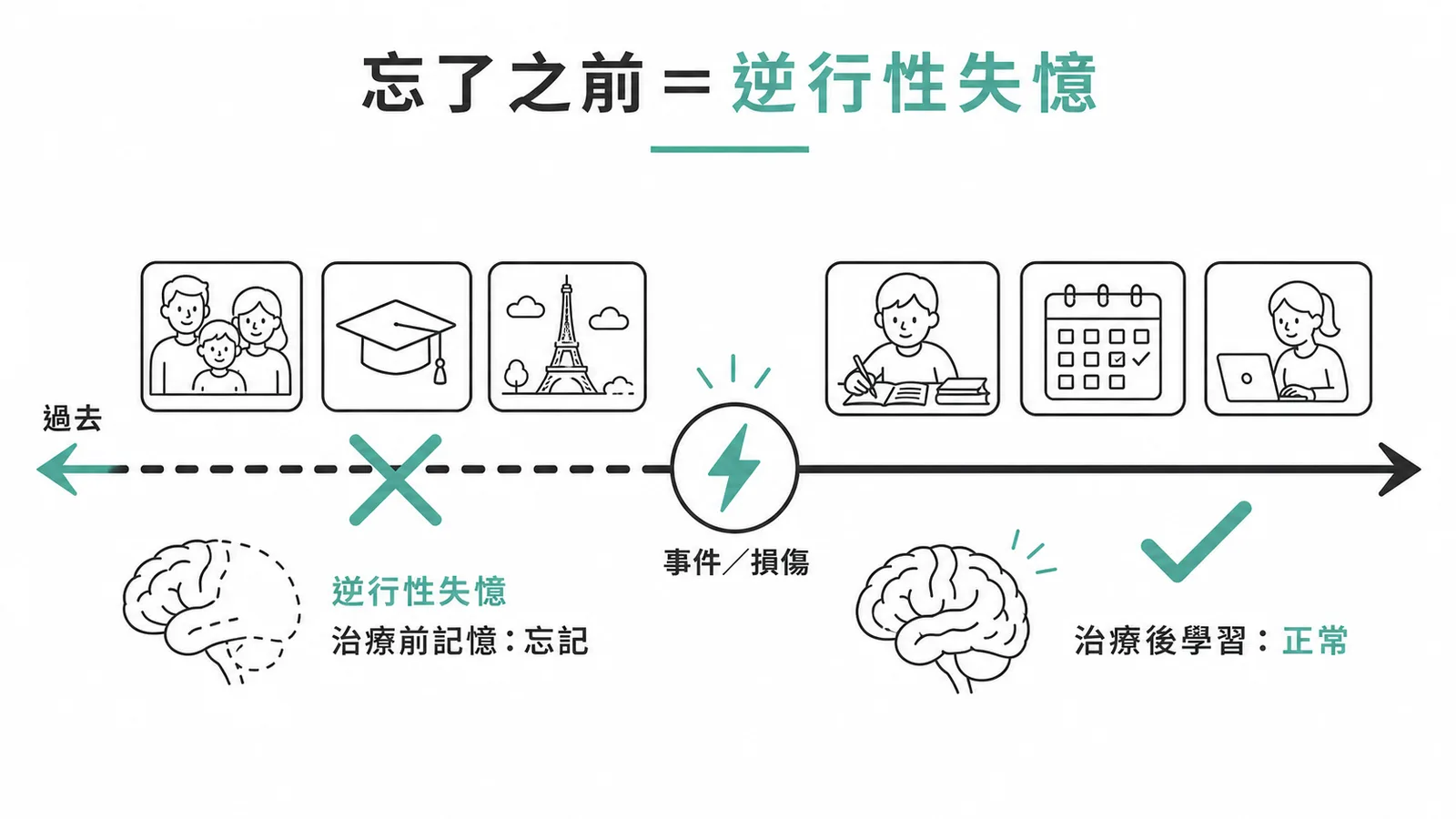 逆行性失憶與順行性失憶的時間軸對照，忘了事件之前的記憶即為逆行性失憶