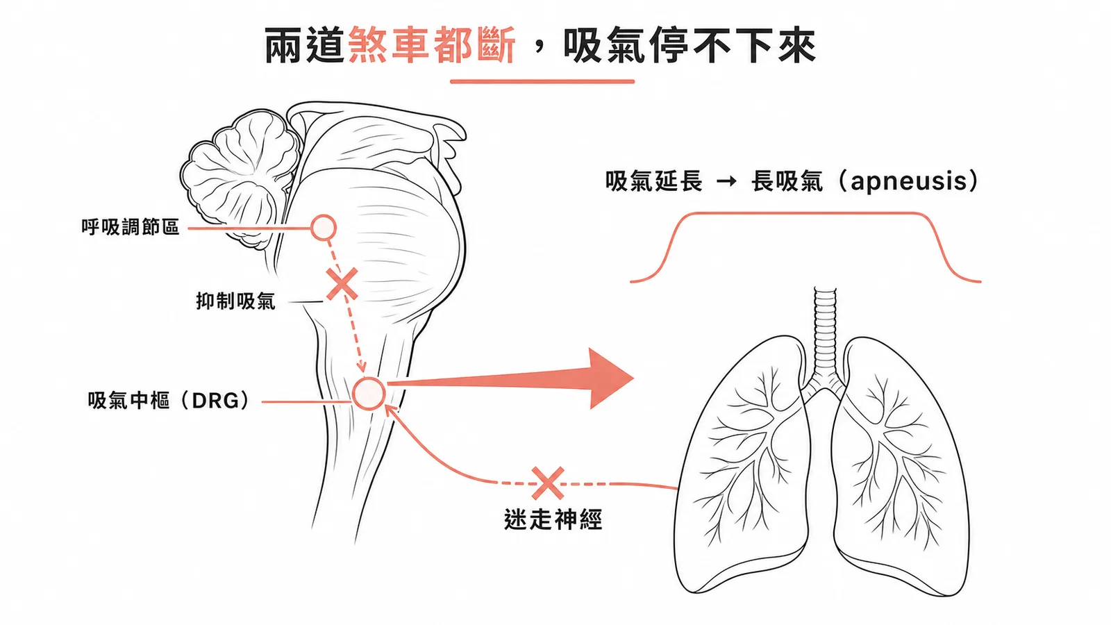 呼吸調節區與迷走神經兩條吸氣抑制路徑被切斷導致長吸氣