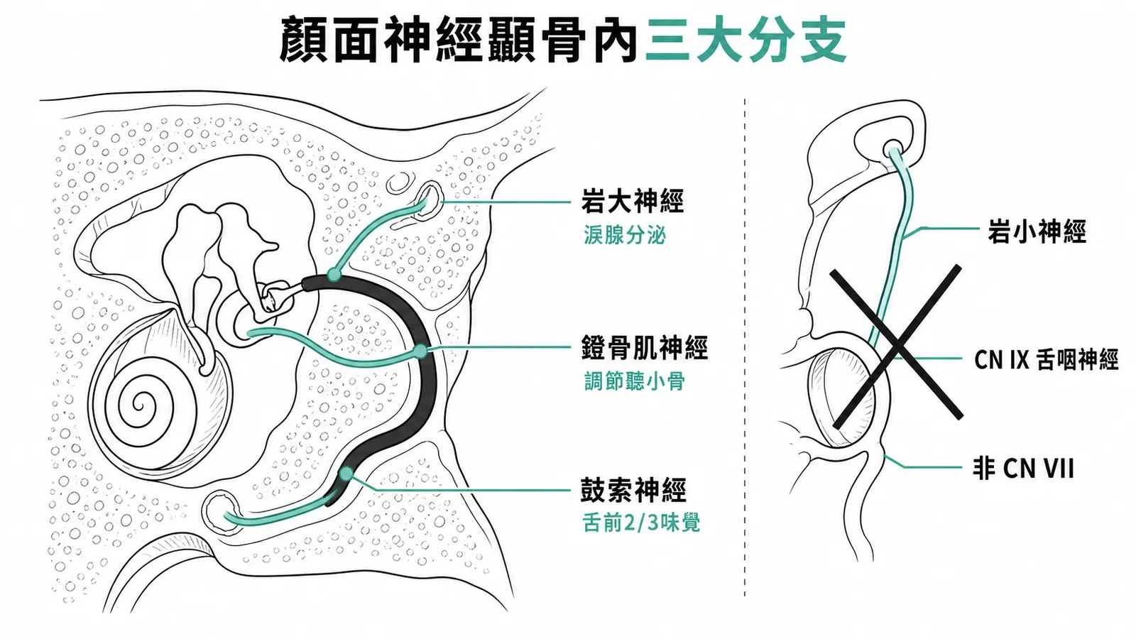 顏面神經顳骨內三大分支與岩小神經歸屬對照圖