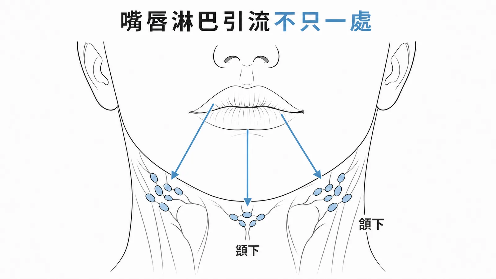 嘴唇淋巴引流至頦下與頷下淋巴結的多條路徑示意圖