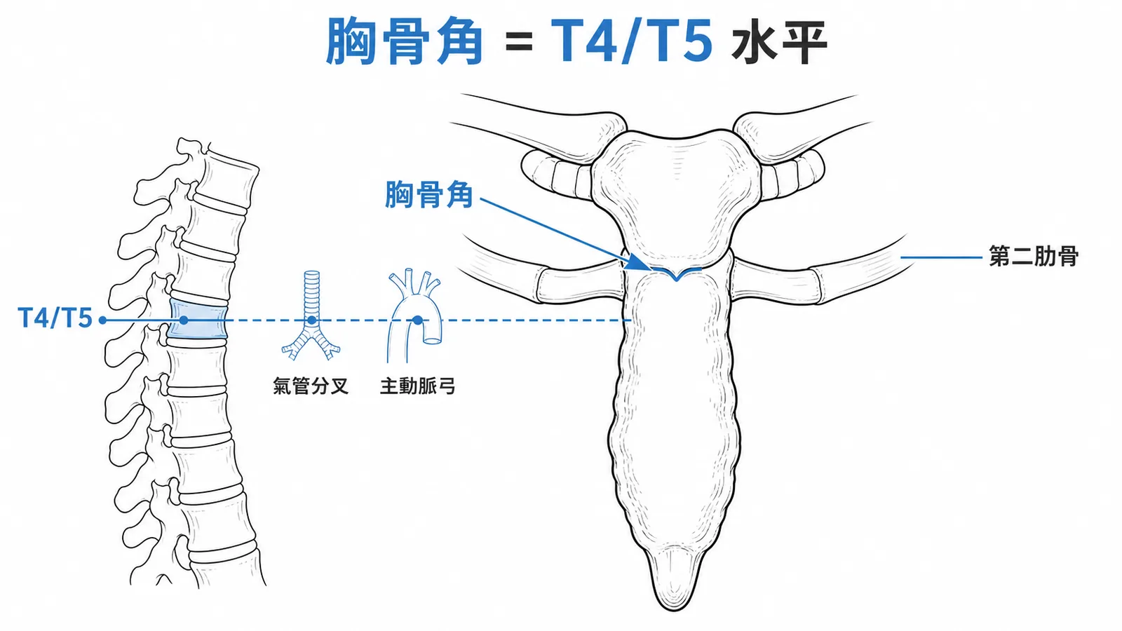 胸骨角位於胸骨柄與胸骨體交界對應T4T5水平連接第二肋骨