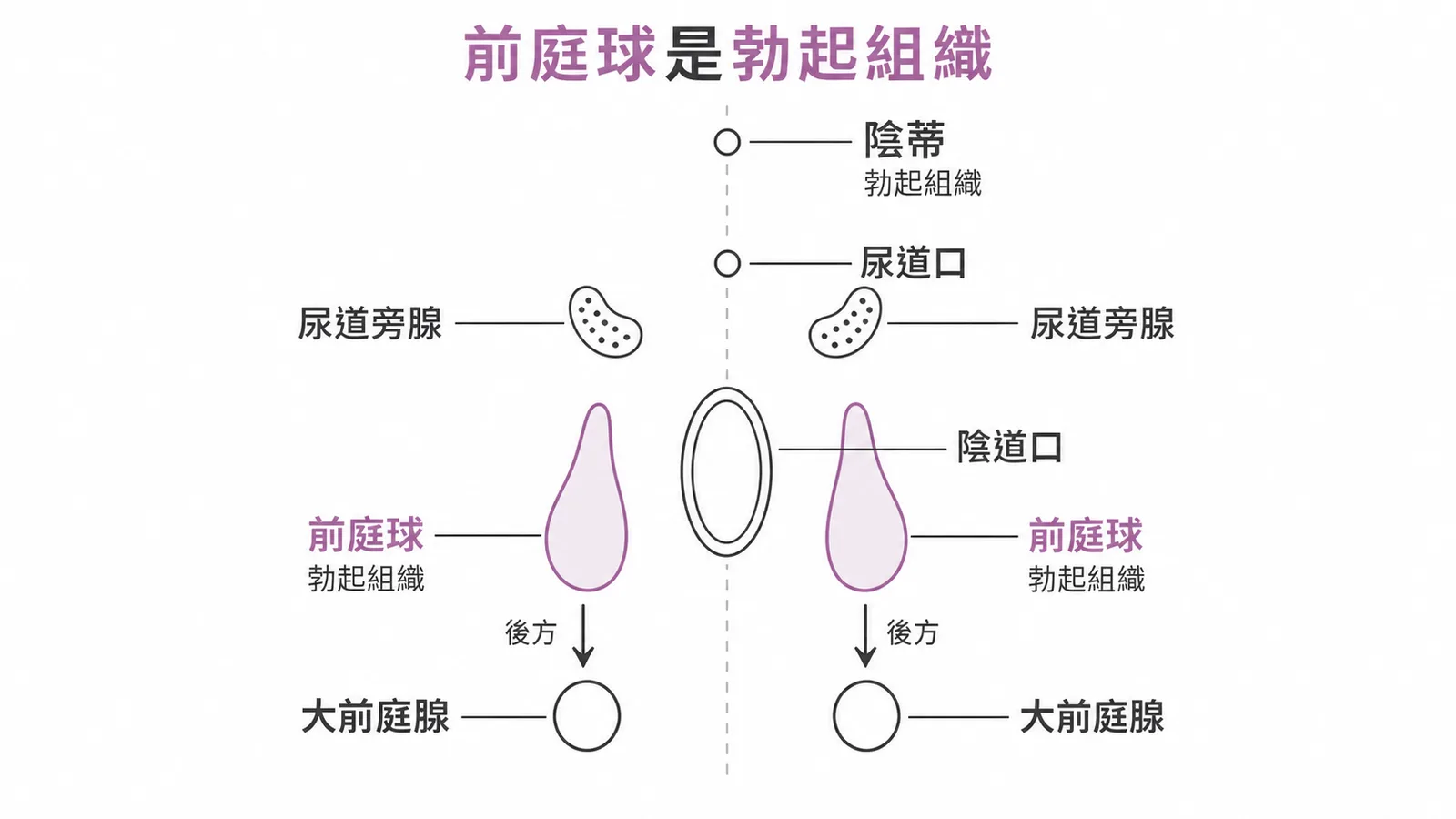 前庭球是勃起組織——女性外陰解剖示意圖,標示陰蒂、前庭球、大前庭腺與尿道旁腺的位置