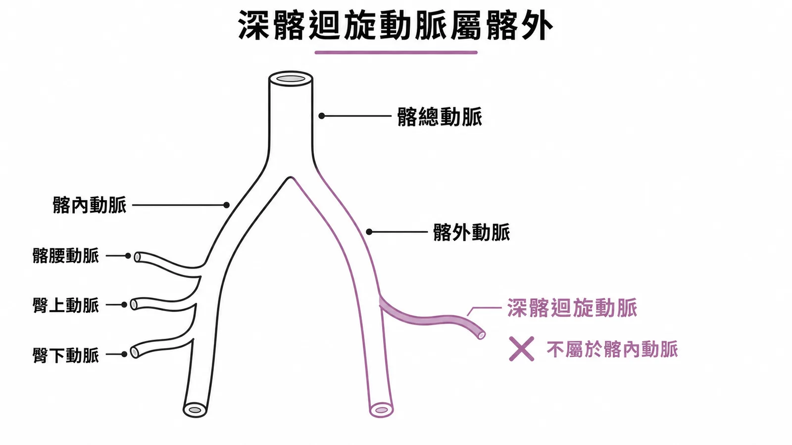 深髂迴旋動脈屬髂外——髂總動脈分叉示意圖,標示髂內與髂外動脈的分支歸屬