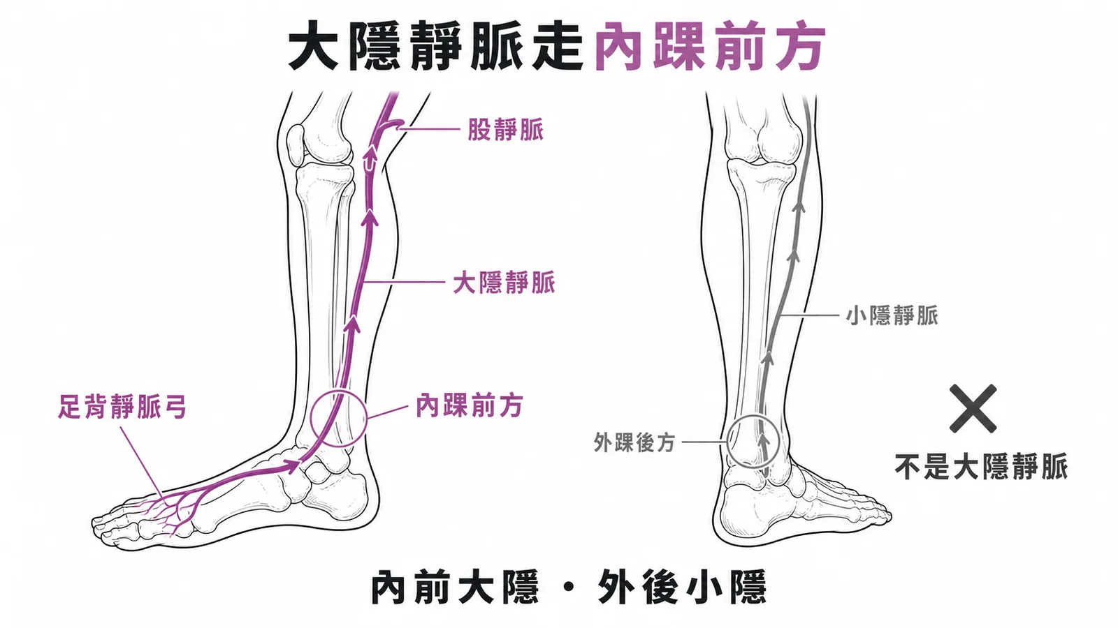 大隱靜脈走內踝前方——下肢靜脈走行示意圖,內前大隱、外後小隱