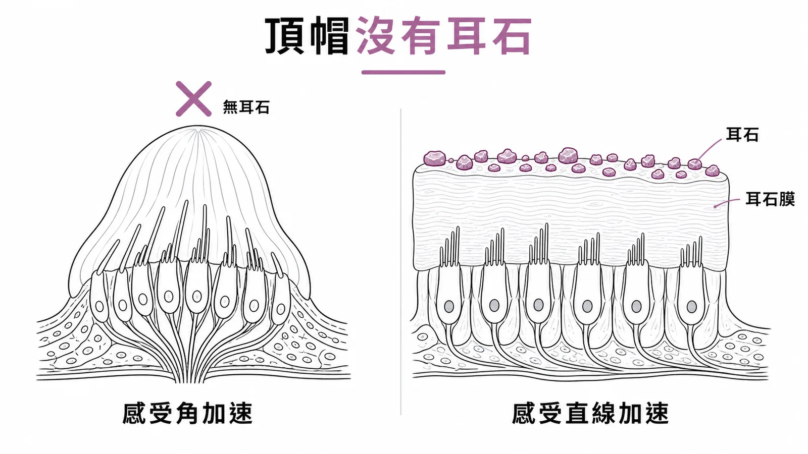 頂帽與耳石膜對比：頂帽無耳石感受角加速，耳石膜有耳石感受直線加速