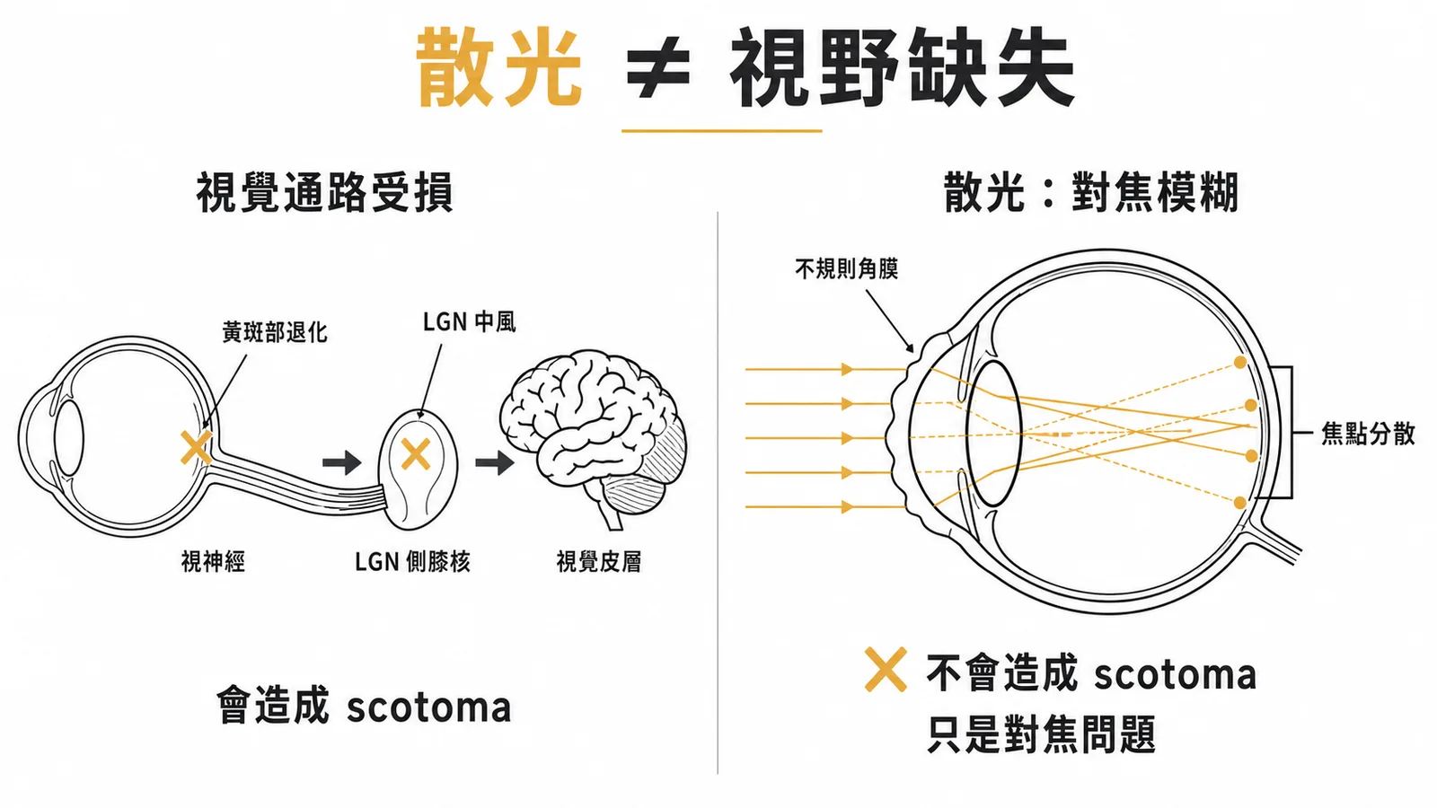 散光與視野缺失的區別：散光是對焦問題不造成scotoma，視覺通路受損才會