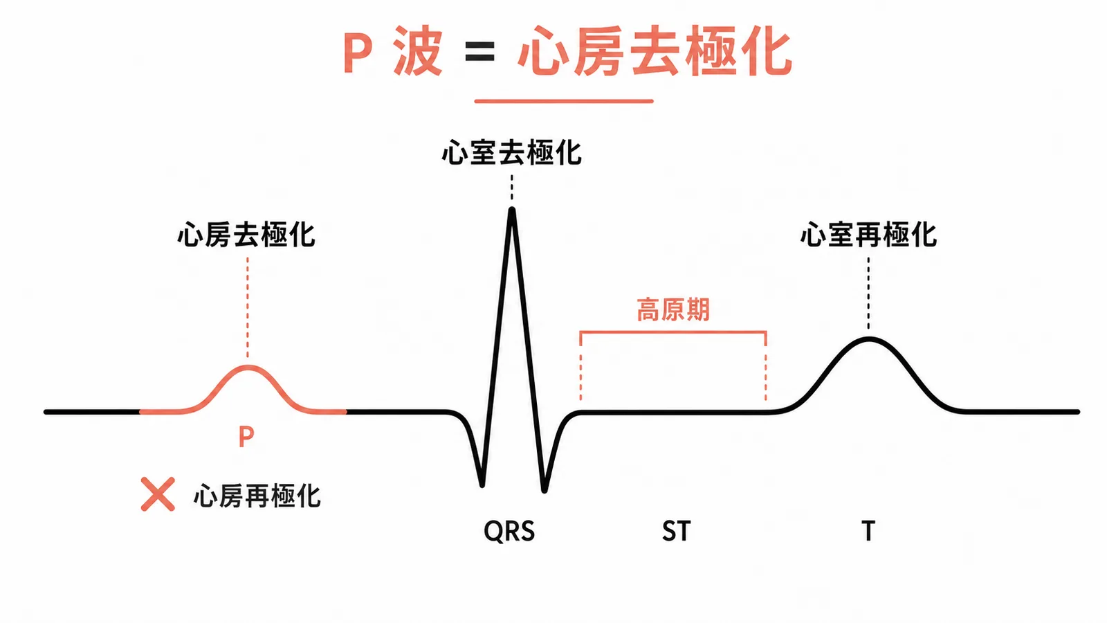 ECG波形對應：P波為心房去極化示意圖